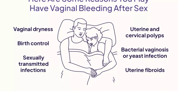 Pse kemi gjaderdhje mbas seksit