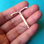 0711_IUD-1000×750-1