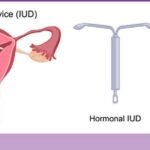 iud-inner-01-desktop