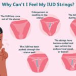 iud-strings-missing-906756_color2-5b92cc2cc9e77c008290970c