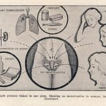 painfulmenstruation